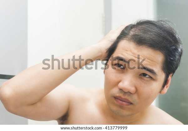 Asian Man Concerned His Hair Loss Stock Photo Edit Now 413779999