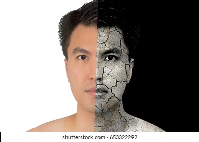 Asian Man Face On Good Healthy Skin And Damaged,dry Skin. Isolated