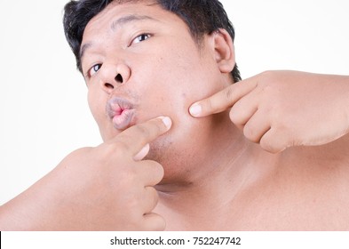 Asian Man Squeezing Pimple On Face