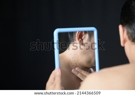 Asian middle man looks in the mirror and point to Skin Tags or Acrochordon on neck isolated on black background. Health care concept