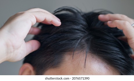 Asian Middle-aged Man Hair Close-up