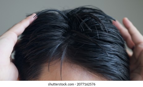 Asian Middle-aged Man Hair Close-up