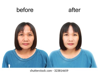 Asian middle-aged woman before and after retouch, concept of makeup or plastic surgery.