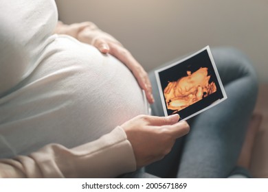 Asian pregnant woman holding ultrasound 4d scan image, Expectation of a child and Maternity prenatal care and woman pregnancy concept.