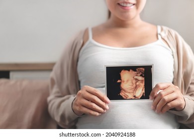 Asian pregnant woman holding ultrasound 4d scan image, Expectation of a child and Maternity prenatal care and woman pregnancy concept. - Powered by Shutterstock