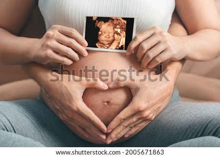 Asian pregnant woman and husband  holding hand together, holding ultrasound 4d scan image and making hand heart gesture on her belly,  Expectation of child and woman pregnancy concept.