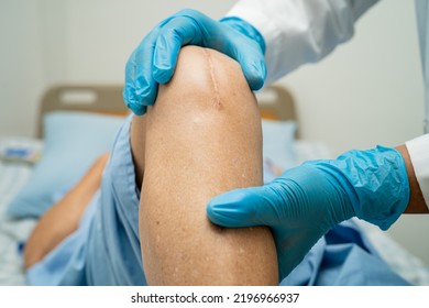 Asian senior or elderly old lady woman patient show her scars surgical total knee joint replacement Suture wound surgery arthroplasty on bed in nursing hospital ward, healthy strong medical concept. - Shutterstock ID 2196966937