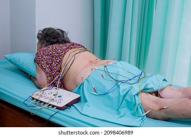 An Asian senior woman lying in bed while undergoing electrical acupuncture procedure for back and hip pain in hospital room