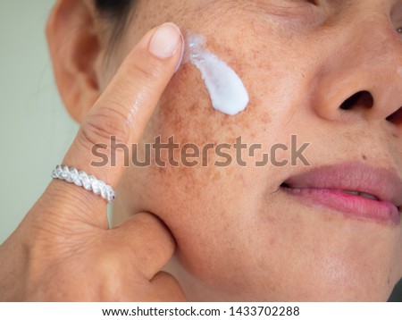Asian woman are applying cream for facial treatment problem spot melasma pigmentation skincare on her face. 
