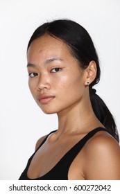 Asian Woman Before Make Up And Hair Do Style Dresser. No Retouch, Fresh Face With Acne, Skin Moles, Wart Then Good Base Foundation Cosmetic Spray Fixer