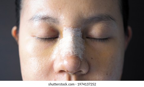 Plastic Surgery Bad High Res Stock Images Shutterstock