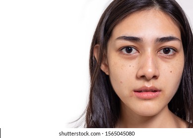 Asian woman gets freckles, blemish, pimple and dull skin on her face. Attractive beautiful Asia woman get eye dark circles, She get no makeup on face. She look unhappy. isolated on white, copy space