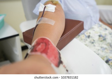 Asian Woman Hand Donating Blood.