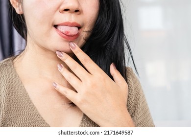 Asian woman have sore in the mouth, tongue, Aphthous Ulcer - Shutterstock ID 2171649587