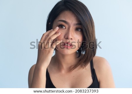 asian woman having eye irritation, red eye inflammation, ophthalmology concept