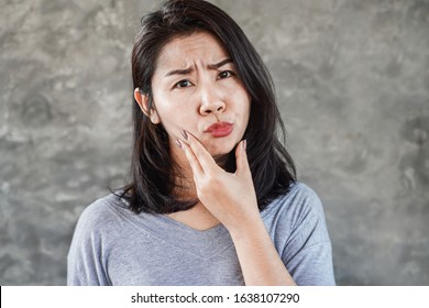 Asian Woman Having Problem With Bell's Palsy/Facial Palsy