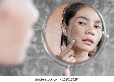 Asiatische Frau mit Hautproblemen, die ihr Gesicht mit dunklem Fleck überprüft, mit Sommersprossen vom UV-Licht im Spiegel
