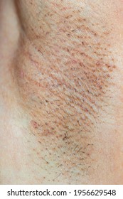 Asian woman having skin problem with black armpits - Shutterstock ID 1956629548