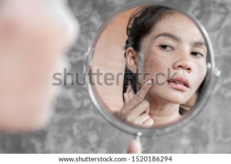 Asian woman having skin problem checking her face with dark spot, freckle from uv light in mirror