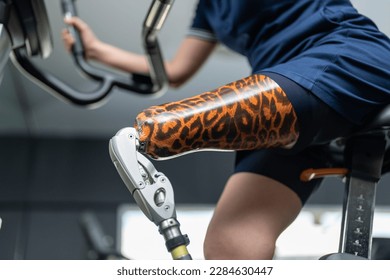 Asian woman with prosthetic leg working out on exercise bike at the gym - Powered by Shutterstock