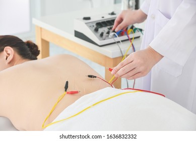 Asian woman receiving acupuncture with electrical stimulator at back ,Alternative medicine concept.