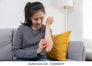 Asian Woman Scratching Her Arm Suffer From Allergy Itchy Skin