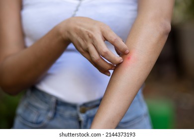 Asian woman scratching her arm skin, health care concept image of mosquito bite, allergic dermis inflammation, fungus infection, dermatology disease, malaria, dengue, tropical mosquito virus infection