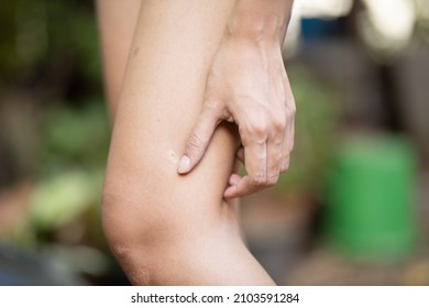 Asian woman scratching her leg skin, concept of dry skin, allergic dermis inflammation, fungus infection, dermatology disease, eczema, rash, skin care