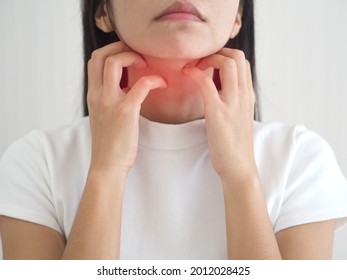 Asian Woman Scratching The Itch On Her Neck With Redness Rash. Cause Of Itchy Skin Include Insect Bites, Dermatitis, Fooddrugs Allergies Or Dry Skin. Health Care Concept. Closeup Photo, Blurred.