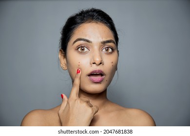 Asian woman shows fingers on acne on her face. female worried about acne or skin breaking out pores,
skincare, cosmetology concept isolated on gray background.