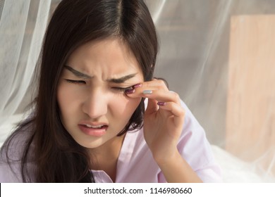 Asian Woman Suffering From Irritated Eye; Concept Of Optical Health Care, Eye Care, Allergic Or Itching Or Dry Eye; 20s Young Adult Asian Woman Model