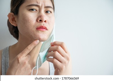 Asian woman worry about acne occur on her face after wearing mask for long time during covid-19 pandemic. Wearing mask for prolonged periods can damage the skin.
