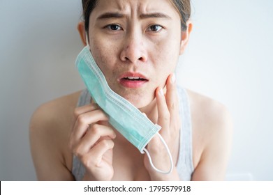 Asian Woman Worry About Acne Occur On Her Face After Wearing Mask For Long Time During Covid-19 Pandemic. Wearing Mask For Prolonged Periods Can Damage The Skin.