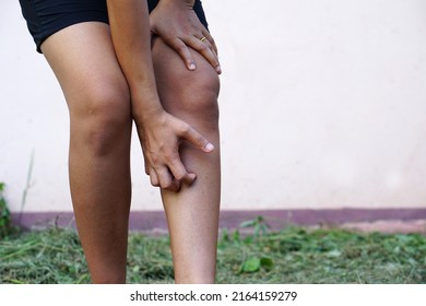 Asian Women Have Itchy Legs.