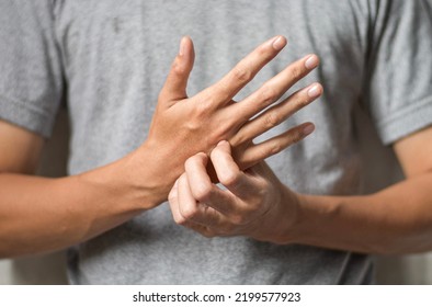 Asian Young Man Scratching His Hand. Concept Of Itchy Skin Diseases Such As Scabies, Fungal Infection, Eczema, Psoriasis, Rash, Allergy, Etc.