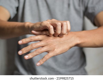 Asian Young Man Scratching His Hand. Concept Of Itchy Skin Diseases Such As Scabies, Fungal Infection, Eczema, Psoriasis, Rash, Allergy, Etc.