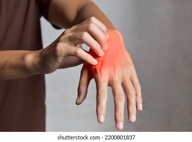 Asian Young Man Scratching His Hand. Concept Of Itchy Skin Diseases Such As Scabies, Fungal Infection, Eczema, Psoriasis, Rash, Allergy, Etc.