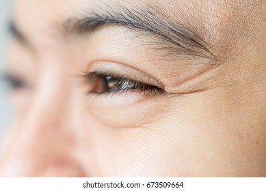 Asian young woman smiling with wrinkles around eye, aging in young, happy eye.