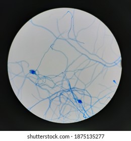 Aspergillus Fumigatus Hyphae By LPCB Stain