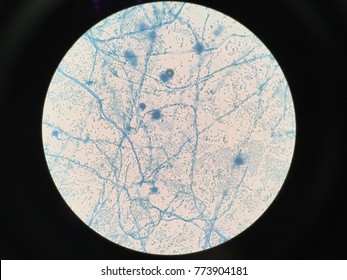 Aspergillus Fumigatus LPCB