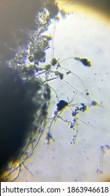 Aspergillus Fumigatus Mold Under The Microscope