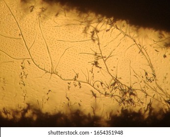 Aspergillus Fumigatus Mycellium, Microscope View