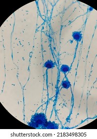 Aspergillus Fumigatus On Microscopic Examination