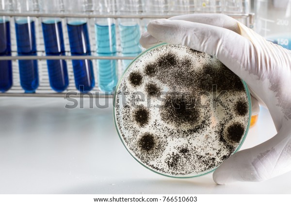 Aspergillus (mold) for\
Microbiology in\
Lab.