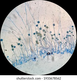 Aspergillus sp. conidia and hyphae  under microscope