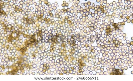 Aspergillus sp. spore under microscope. No staining. 40x objective + camera zoom. Selective focus image