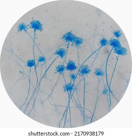 Aspergillus Sp.conidia And Conidiophore .under The Micro Scope 400 X.