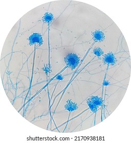 Aspergillus Sp.conidia And Conidiophore .under The Micro Scope 400 X.