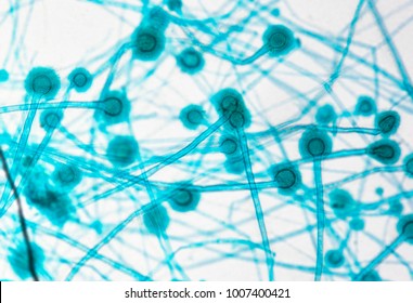 Aspergillus Under Microscope 