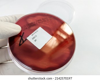 ATCC Staphylococcus aureus: Gram-positive, to Gram-variable, nonmotile, Coccus,beta haemolysis, saprotrophic bacterium that belongs to the family Staphylococcus growth on blood agar.